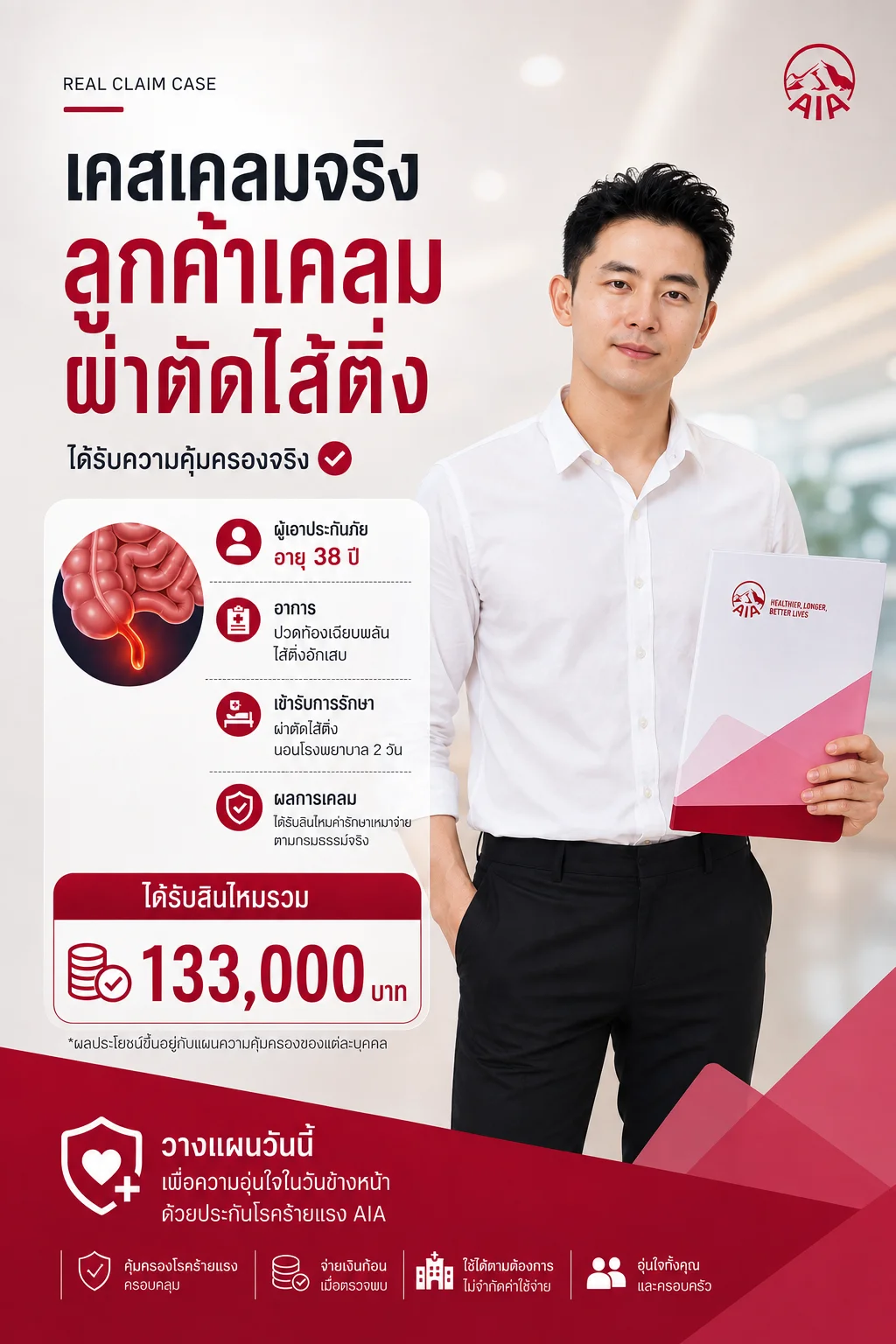 ประกันสุขภาพ ผ่าตัดไส้ติ่ง